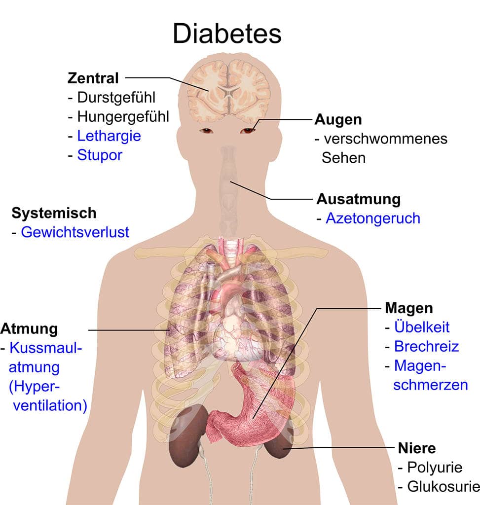 Осложнения при диабете
