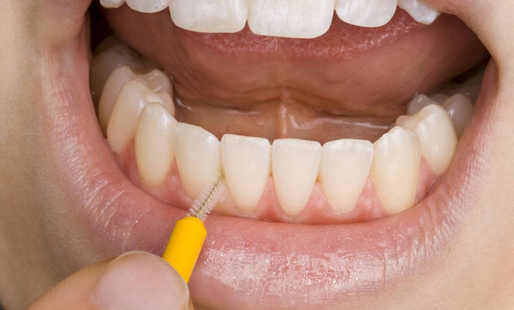 Гигиена зубов
